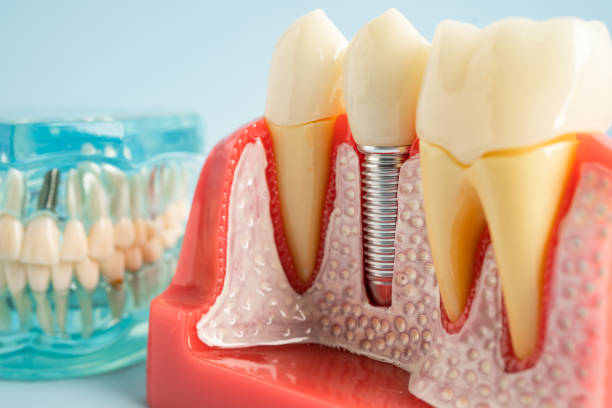 Professional Dental Services in Hamburg, PA